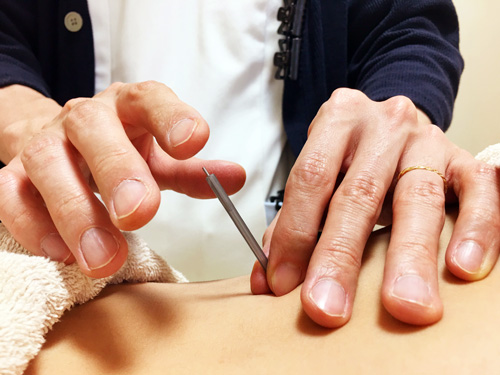 施術　高知　はりきゅう　不妊　鍼灸　難聴　小児鍼　はる鍼灸治療院 高知　はりきゅう　不妊　鍼灸　難聴　小児鍼　はる鍼灸治療院 高知　はりきゅう　不妊　鍼灸　難聴　小児鍼　はる鍼灸治療院 高知　はりきゅう　不妊　鍼灸　難聴　小児鍼　はる鍼灸治療院 高知　はりきゅう　不妊　鍼灸　難聴　小児鍼　はる鍼灸治療院 高知　はりきゅう　不妊　鍼灸　難聴　小児鍼　はる鍼灸治療院 高知　はりきゅう　不妊　鍼灸　難聴　小児鍼　はる鍼灸治療院 高知　はりきゅう　不妊　鍼灸　難聴　小児鍼　はる鍼灸治療院 高知　はりきゅう　不妊　鍼灸　難聴　小児鍼　はる鍼灸治療院 